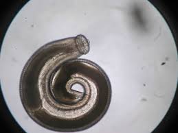 Gnathostoma spinigerum